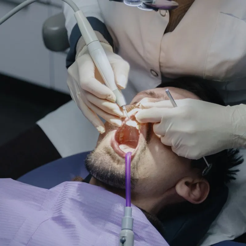 Root Canal Treatment